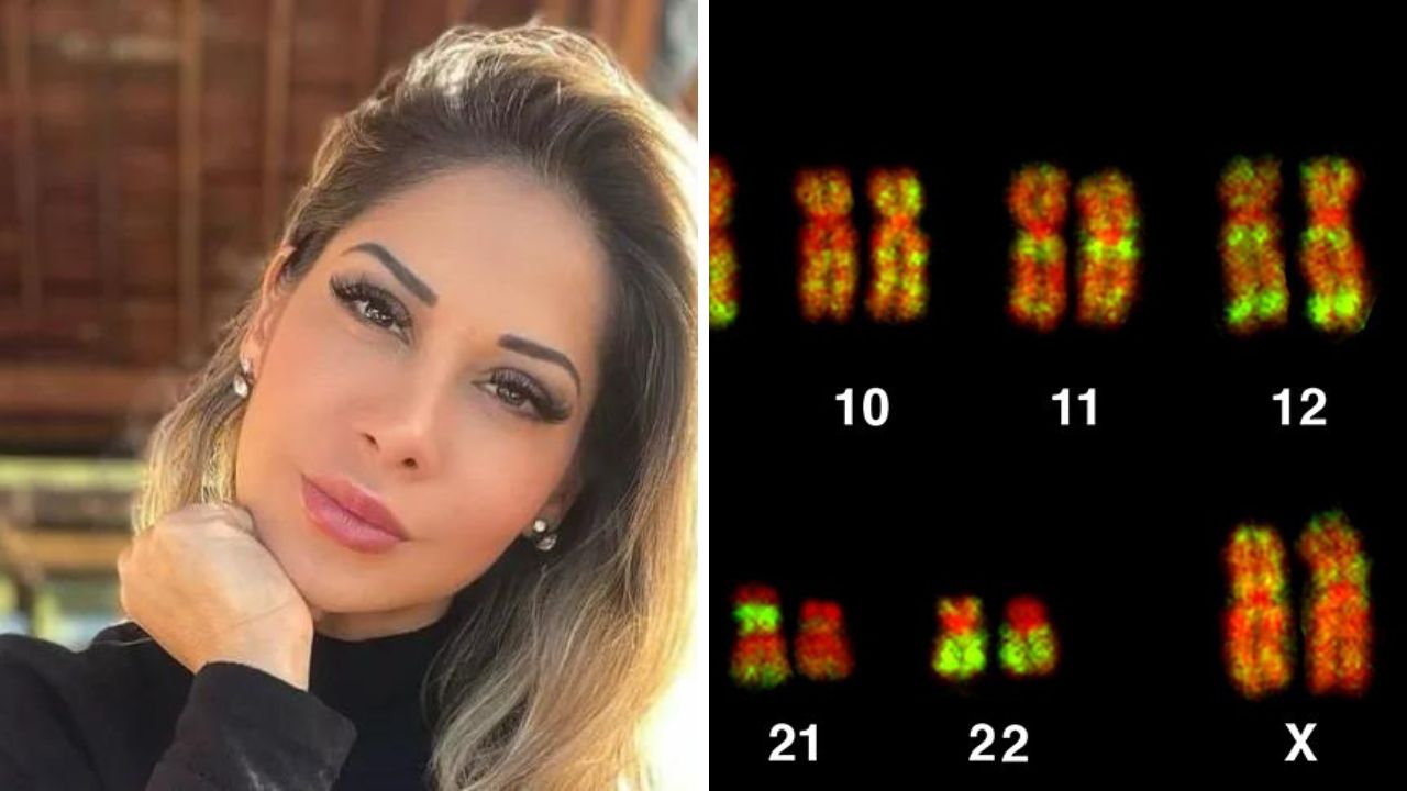 Colagem de duas imagens, na esquerda Maíra Cardi e à direita a imagem dos cromossomos do DNA humano