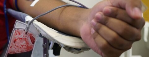Braço de uma pessoa negra que está doando sangue