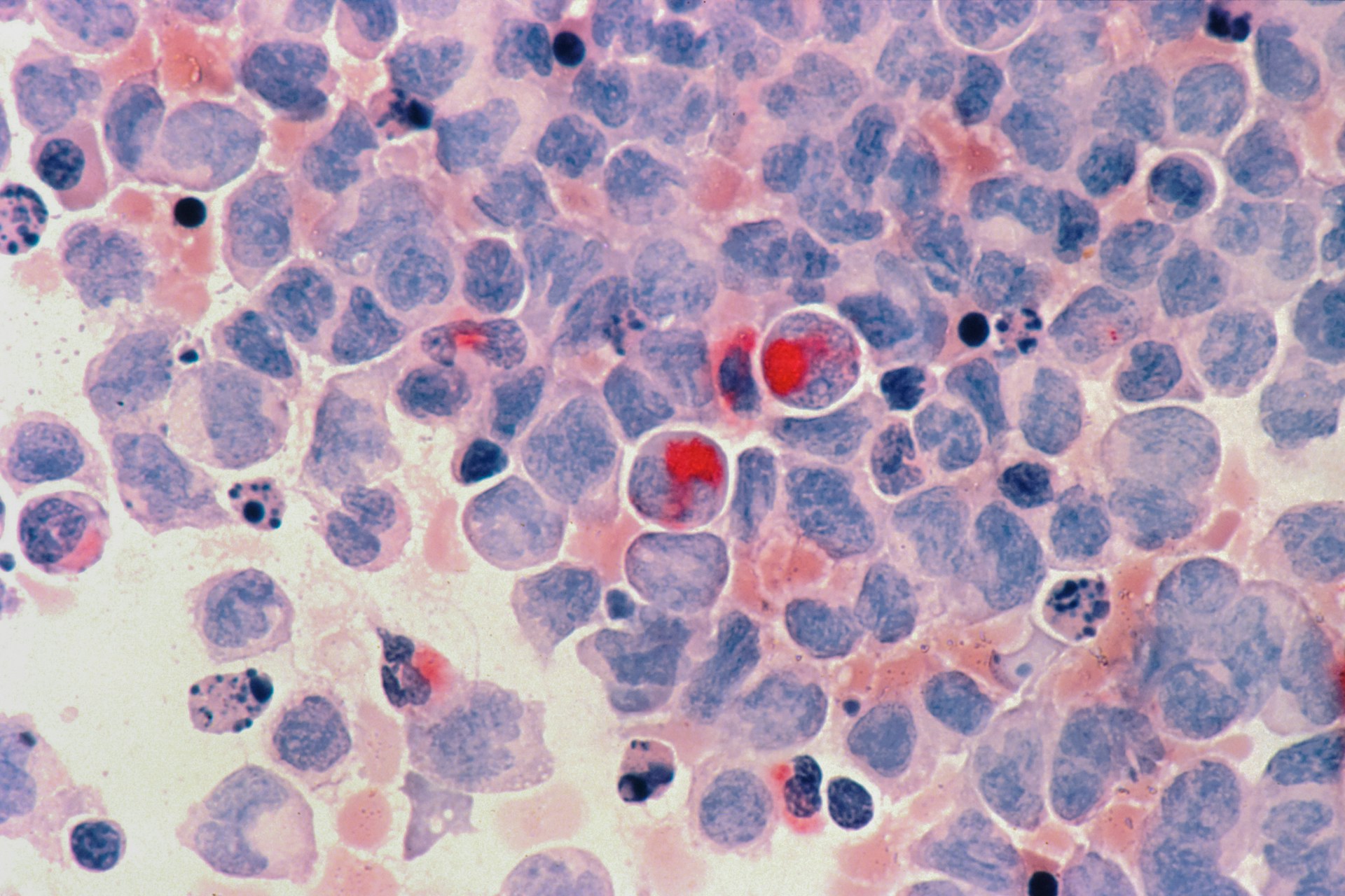 Foto de National Cancer Institute na Unsplash